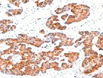 Basic Cytokeratin Antibody - image 1