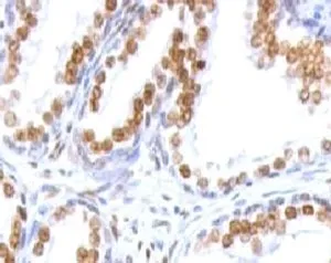 Androgen Receptor Antibody - image 1