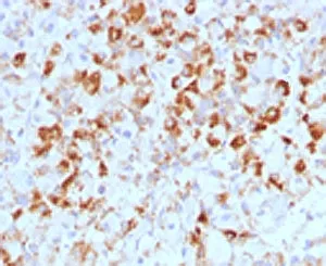 Luteinizing Hormone beta Antibody - image 1