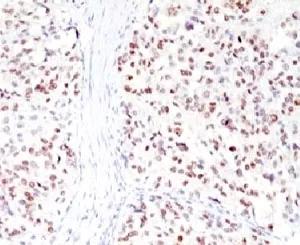 MITF Antibody - image 1