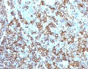 HLA-DRB1 Antibody (MHC II) - image 1