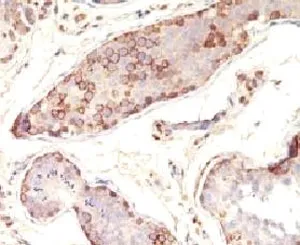 MAGE-1 Antibody - image 1