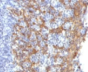 Cytokeratin 14 Antibody / CK14 / KRT14 - image 1