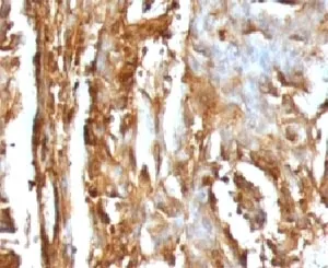 Beta-2 Microglobulin Antibody - image 1