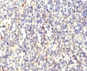 TRAcP Antibody / TRAP / ACP5 - image 1