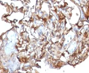 CD146 Antibody / MCAM / MUC18 - image 1