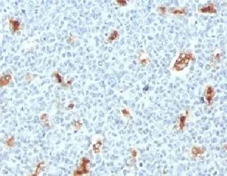 S100A9 Antibody / MRP14 / Calgranulin B / Calprotectin L1H - image 1