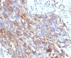 NCAM / CD56 Antibody - image 1