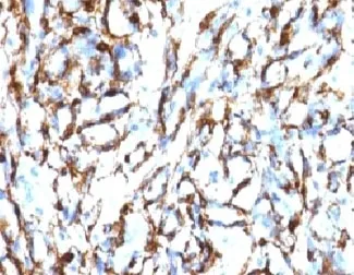 Alpha Actin Antibody / ACTA2 (smooth muscle) - image 1