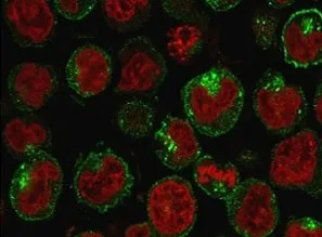 Transferrin Receptor Antibody / TFRC / CD71 - image 1