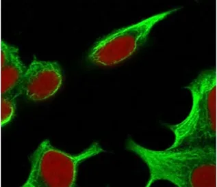 TNF alpha Antibody - image 1