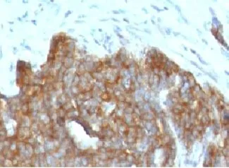Estrogen Inducible Protein pS2 / TFF1 Antibody - image 1