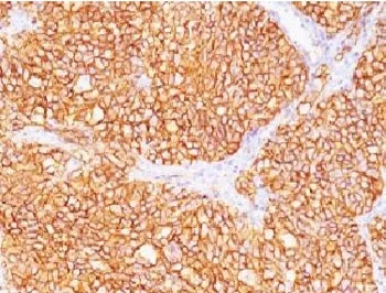 CA9 Antibody / Carbonic Anhydrase IX - image 1