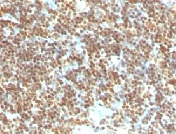 dsDNA Antibody / Double Stranded DNA - image 1