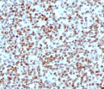 Nucleolin Antibody - image 1