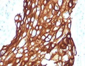 Acidic Cytokeratin Recombinant Antibody - image 1