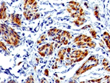 Caldesmon / CAD Recombinant Antibody HMW - image 1