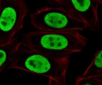 Ku70 + Ku80 Antibody - image 1