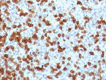 PDCD1 Recombinant Antibody / PD-1 / PD1 - image 1