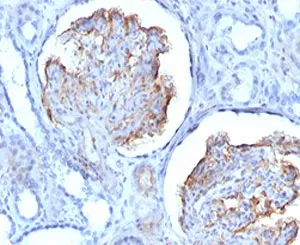 WT1 Recombinant Antibody / Wilms Tumor 1 - image 1