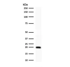 FTL Antibody / Ferritin light chain - image 1