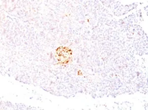 NSE Antibody / Neuron Specific Enolase - image 1