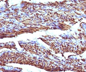 Calponin 1 Recombinant Antibody - image 1