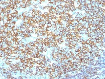 CD20 Recombinant Antibody - image 1