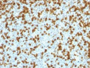 PDCD1 Recombinant Antibody / PD-1 / PD1 - image 1