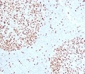 Topoisomerase II alpha Antibody / TOP2A - image 1
