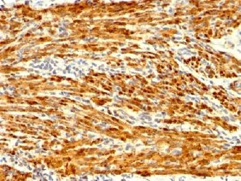 Calponin 1 Recombinant Antibody - image 1