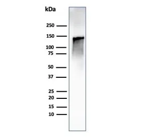Caldesmon / CAD Recombinant Antibody HMW - image 1