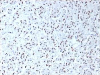 WT1 Recombinant Antibody / Wilms Tumor 1 - image 1