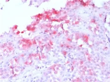 MART-1 / Melan-A Recombinant Antibody - image 1