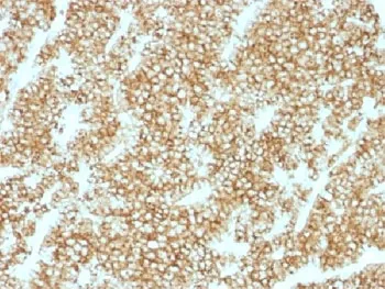 Parathyroid Hormone Recombinant Antibody / N Terminal - image 1