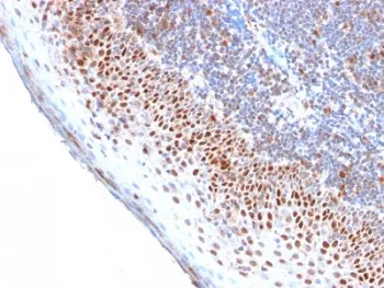 MCM7 Recombinant Antibody - image 1