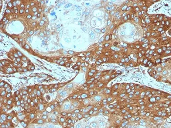 RPSA Antibody / 40S Ribosomal protein SA - image 1