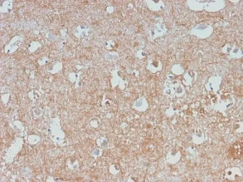 Neurofilament Recombinant Antibody (-Light) / NF-L / NEFL - image 1