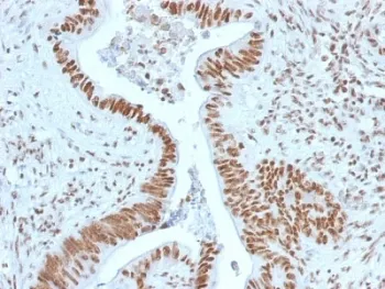 Nucleophosmin Antibody / NPM1 - image 1