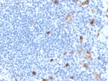 IgM Heavy Chain Recombinant Antibody - image 1
