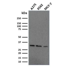 RPA32 Antibody / Replication Protein A2 - image 1