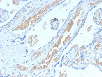 SPTA1 Recombinant Antibody / Spectrin alpha 1 - image 1