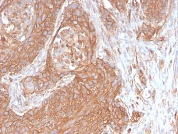 SPTBN2 Recombinant Antibody / Spectrin beta III - image 1
