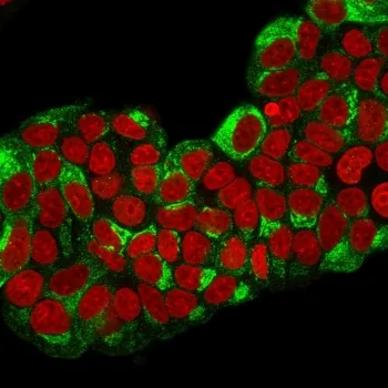 Estrogen Inducible Protein pS2 / TFF1 Antibody - image 1