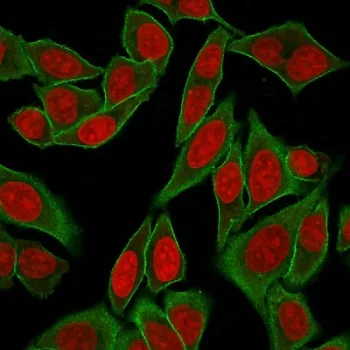 SPTBN2 Recombinant Antibody / Spectrin beta III - image 1