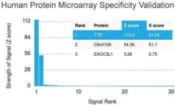 TTR Antibody / Transthyretin / Prealbumin - image 1