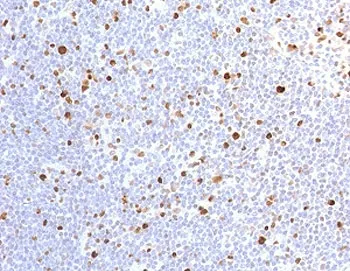 MCM7 Recombinant Antibody - image 1