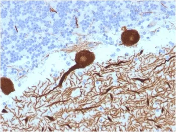 CA8 Antibody / Carbonic Anhydrase VIII - image 1