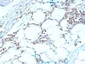 Calbindin 2 Antibody / CALB2 / Calretinin - image 1