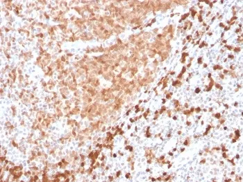 TCL1 Recombinant Antibody - image 1